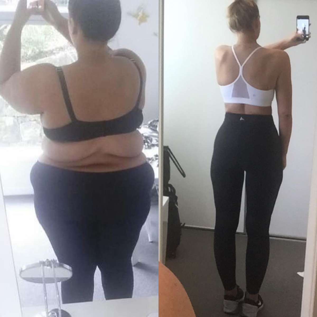 Спина до и после похудения