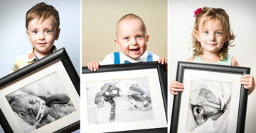 Impresionantes fotografías del antes y el después de bebés que nacieron prematuros