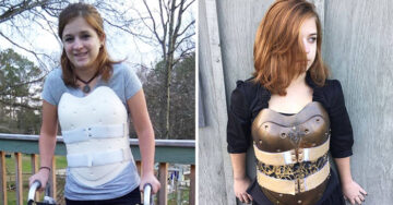 Esta chica transformó su corsé ortopédico en una armadura steampunk y luce increíble