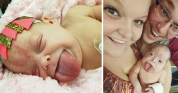Esta bebé nació con la lengua de un adulto, pero después de una cirugía finalmente pudo sonreír