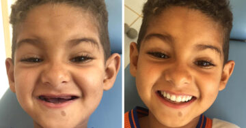 Este pequeño soñaba con tener dientes como sus amigos y este dentista hizo su sueño realidad