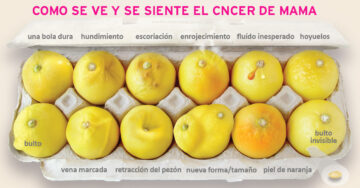 12 limones que pueden ayudarte a detectar el cáncer de mama