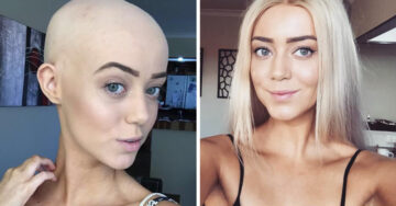 Modelo con alopecia envía un gran mensaje a sus seguidores en Instagram