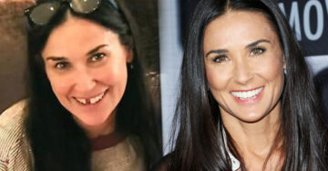 Demi Moore revela que perdió los dientes frontales a causa del estrés; la imagen es impactante