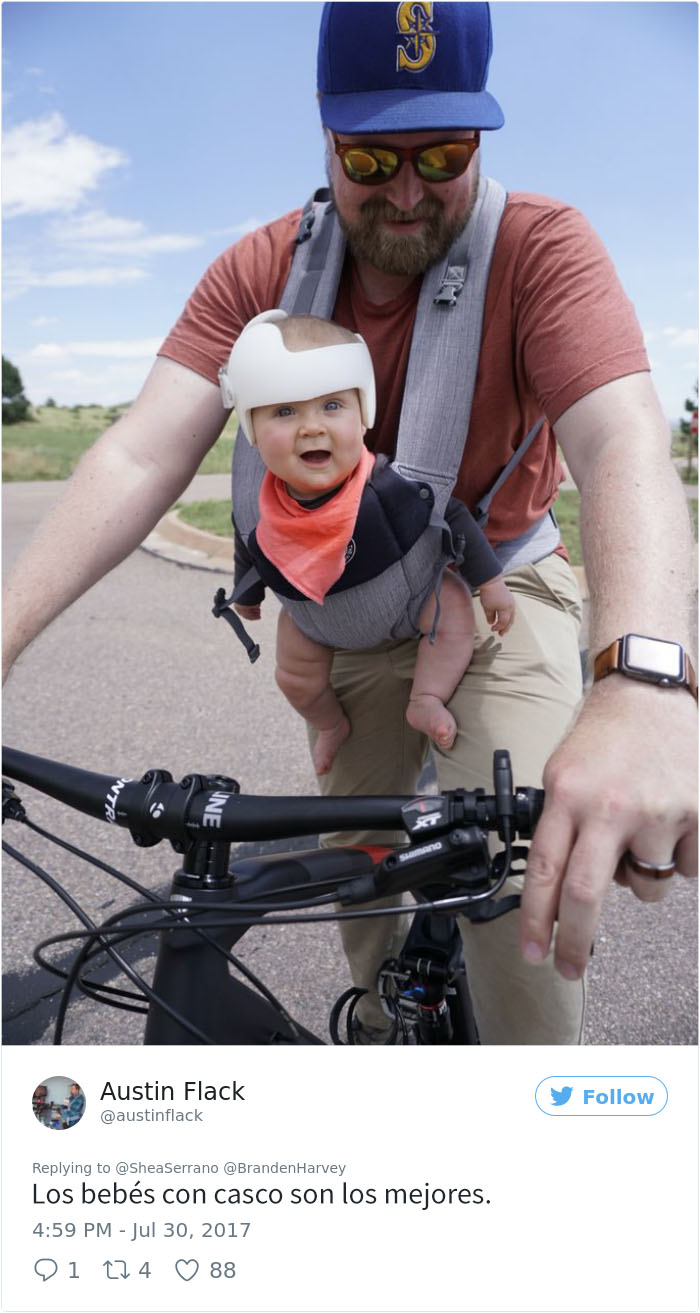 Su bebé debe usar casco por una enfermedad, así que toda la familia adoptó  la moda (FOTOS)