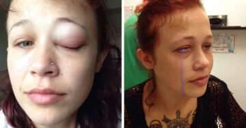 Tatuaje en los ojos la deja parcialmente ciega; comparte su historia para crear conciencia