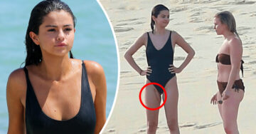Selena Gomez reaparece con una gran cicatriz en la playa y sus fans reaccionan sorprendidos