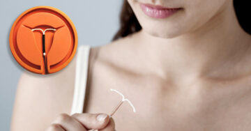 Llega nuevo método anticonceptivo; ¡su duración es de 5 años y contiene menos hormonas!