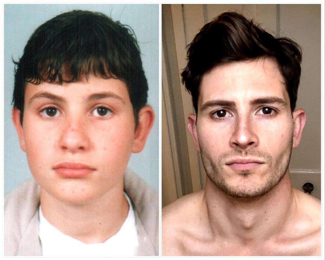 Какого года человек если ему 14. Люди изменившие внешность. Некрасивое мужское лицо. Изменение лица человека.