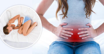 Cáncer de ovario puede confundirse con colitis