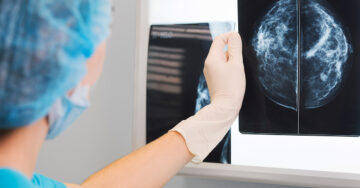 Inteligencia artificial ayudaría a detectar cáncer de mama