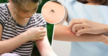 ¿Por qué los mosquitos parecen más atraídos por algunas personas?