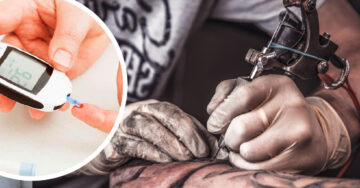 Inventan tinta para tatuaje que cambia de color según niveles de glucosa