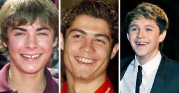 20 Fotos de famosos antes y después de usar brackets