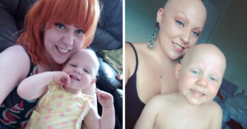 Madre e hija con alopecia muestran al mundo su belleza natural
