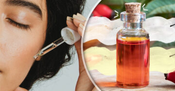 9 Beneficios que el aceite de rosa mosqueta aporta a tu piel