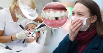 La caída de dientes puede ser un efecto secundario del Covid-19