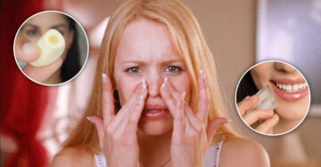 14 Tips naturales para evitar los brotes de acné