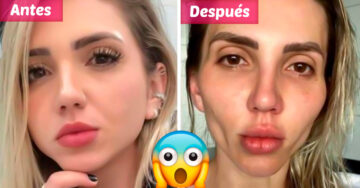 Influencer se arrepiente de hacerse bichectomía; siente que perdió naturalidad