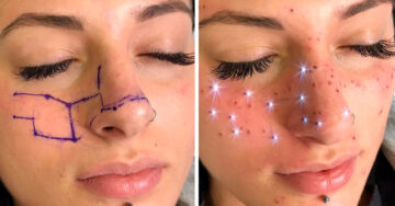 ‘Astro Frecks’, las pecas de constelación semipermanentes que vas a querer