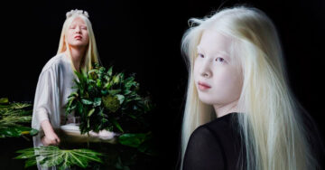 Fue abandonada por su albinismo cuando era niña; hoy modela para ‘Vogue’