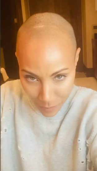 Jada Pinkett sufre alopecia y habla de cómo la ha afrontado