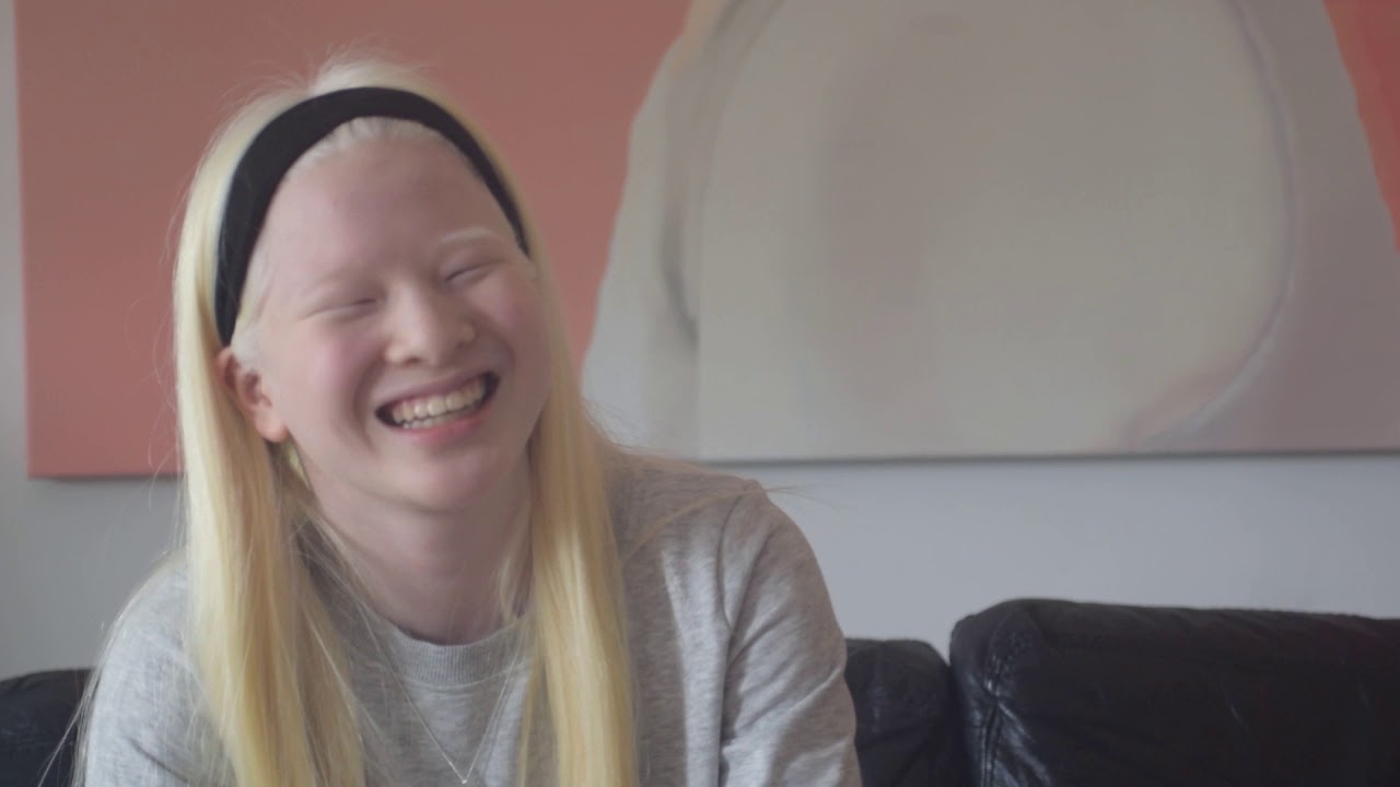 Girl Who Was Abandoned For Her Albinism Today Models In Vogue Bullfrag