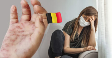 Bélgica es el primer país en declarar cuarentena obligatoria por viruela del mono