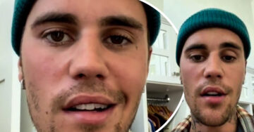 Justin Bieber revela en un video que la mitad de su rostro está paralizado por un síndrome