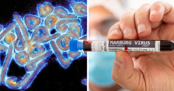 Ghana confirma el primer brote del virus de Marburg… y es altamente infeccioso