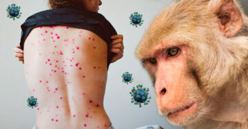 OMS pide tomar en serio la viruela del mono; ya se triplicaron los casos en Europa