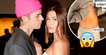 Hailey Bieber desmiente los rumores de embarazo y revela la terrible enfermedad que sufre