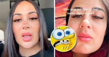 Influencer se desfigura la mandíbula luego de una cirugía mal practicada