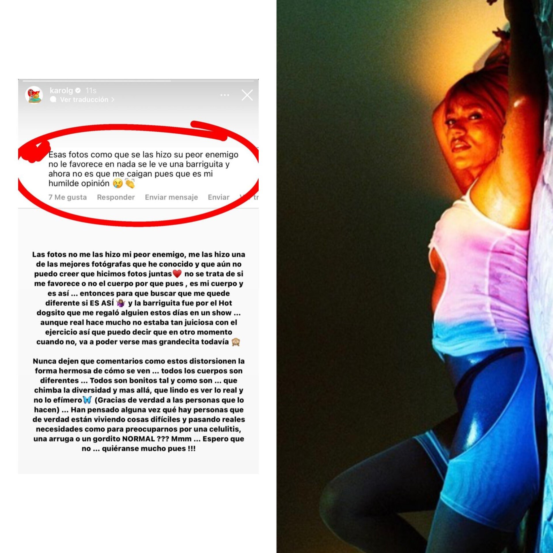 Karol G Responde A Fan Que Criticó Su Aspecto En Fotografías