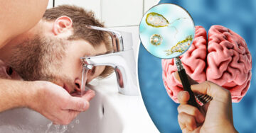 Hombre muere al contraer ‘ameba comecerebros’ por lavarse la nariz con agua del grifo