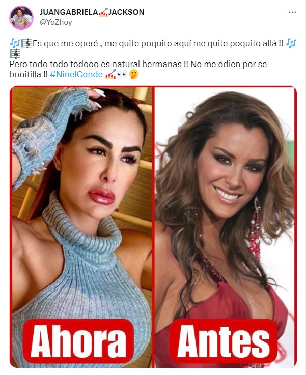 Ninel Conde shares the photos of her new face and unleashes a rain of criticism World Stock Market