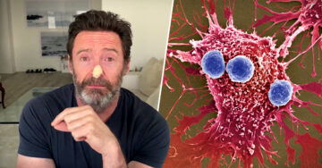 Hugh Jackman podría tener cáncer de piel y pide a sus fans protegerse del sol