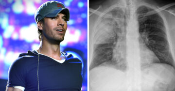 Enrique Iglesias es diagnosticado con neumonía y esto se sabe sobre su salud